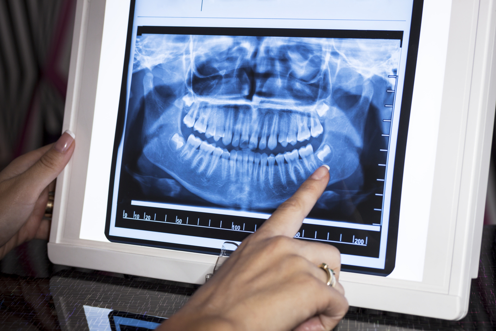 dental xrays Johnson Family Dental Paducah KY