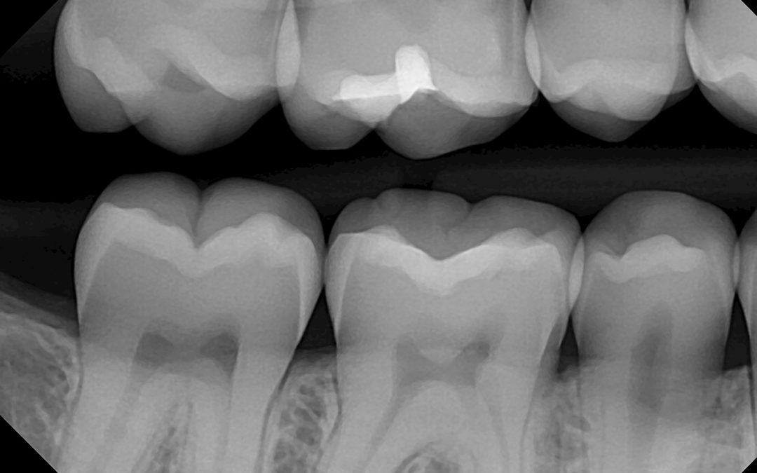 Dental XRays Paducah KY