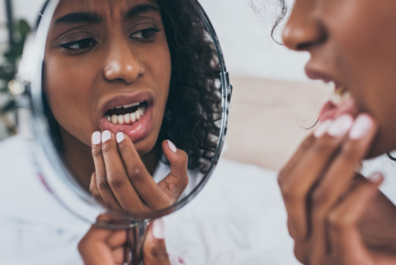 Cracked tooth Paducah Dentist